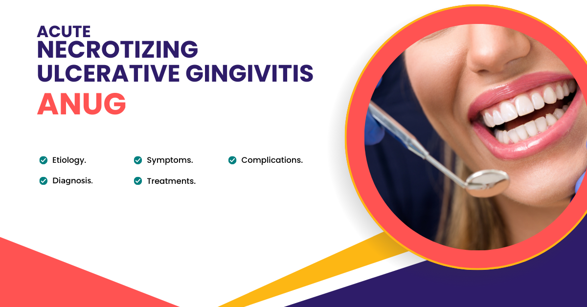 acute necrotizing ulcerative gingivitis ANUG